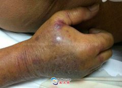 <b>�����ʴ��˵��˿ڣ�С��ʳ�����Ⱦ</b>